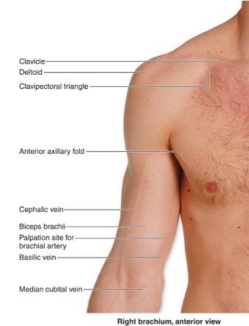 pectoralis = loge van Morrisson) Proximaal en distaal vene met Vicryl 4-0 omteugelen Venotomie Katheter opschuiven via