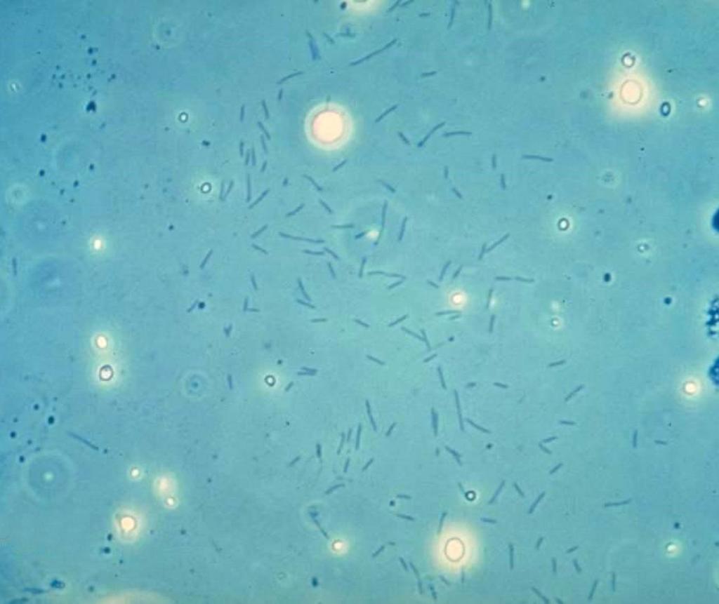 37 Bacteriën Aeromonas en Pseudomonas Myxobacteriën: Vooral bij kweekvissen met beschadigingen en stress.