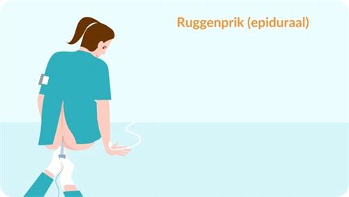 Volgens de Nederlandse CBO richtlijn pijnbehandeling tijdens de bevalling is remifentanil binnen de verloskunde wel goedgekeurd voor indicatie pijnstilling (bv als u geen ruggenprik zou mogen i.v.m. een bloedziekte of bij gebruik van bloedverdunners).