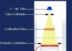 Detectors: 1-slice 4-slices