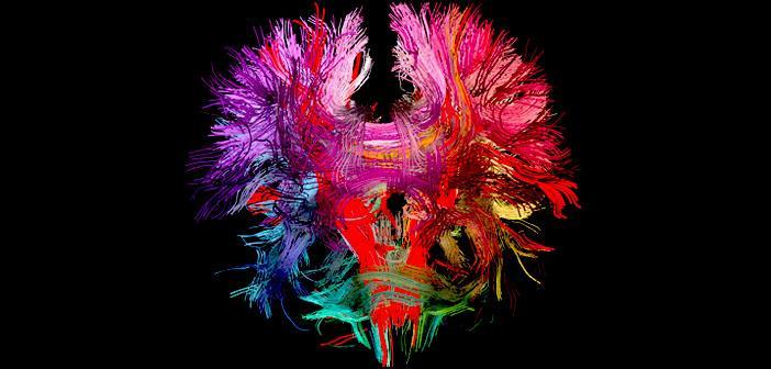 Cerebral Blood Flow Onderzoek 2010.