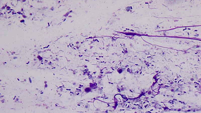 Kat: Case 1 Diagnostiek Vermoeden triaditis Aspiratie gal Cytologie/cultuur Positief in 36% van de patiënten Aanvullend bloedonderzoek fpli/dggr Vitamin B12/foliumzuur Toxoplasma, FIV/FeLV, feces