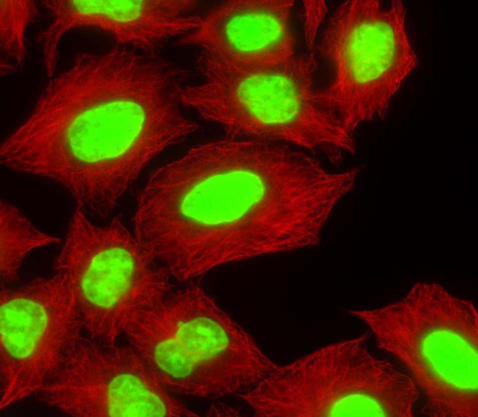 Dag 2 Microtubuli Voorbereidende opdracht Dag 2: College wetenschapper Eigen preparaten bekijken