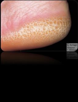 Epidermis: