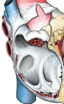 cava superior Arcus aortae Ductus arteriosus = Botalli A