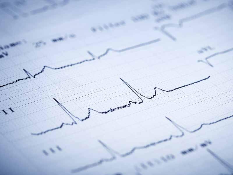 Hoe wordt een hartinfarct vastgesteld? De ambulanceverpleegkundige vraagt waar de pijn precies zit en hoe erg deze is. Meestal vermoedt hij (of zij) dan al dat er sprake is van een hartinfarct.