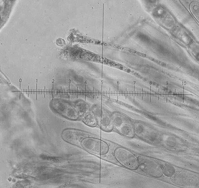 Foto 1., asci en parafysen van Anthracobia macrocystis; 1 streepje = 1 µm (foto Hans Baeté) 
