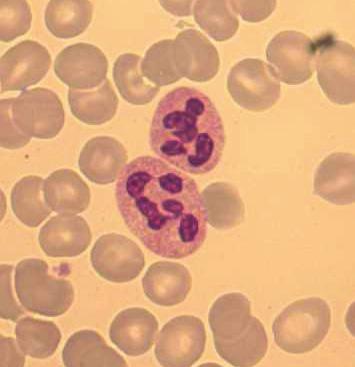 Achtergronden bij de kernsegmentatie van granulocyten