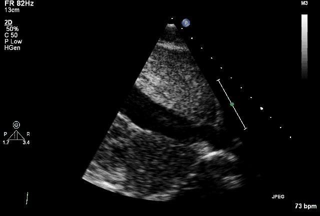 Echocardiografische bepaling van Situs Situs