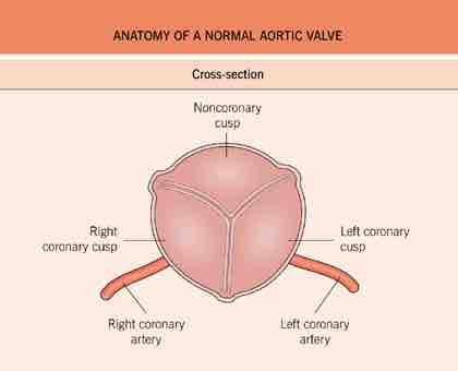 aortaklepstenose echocardiografie STRUCTURELE afwijkingen van de aortaklep - tricuspide of bicuspide aanleg - verdikkingen,