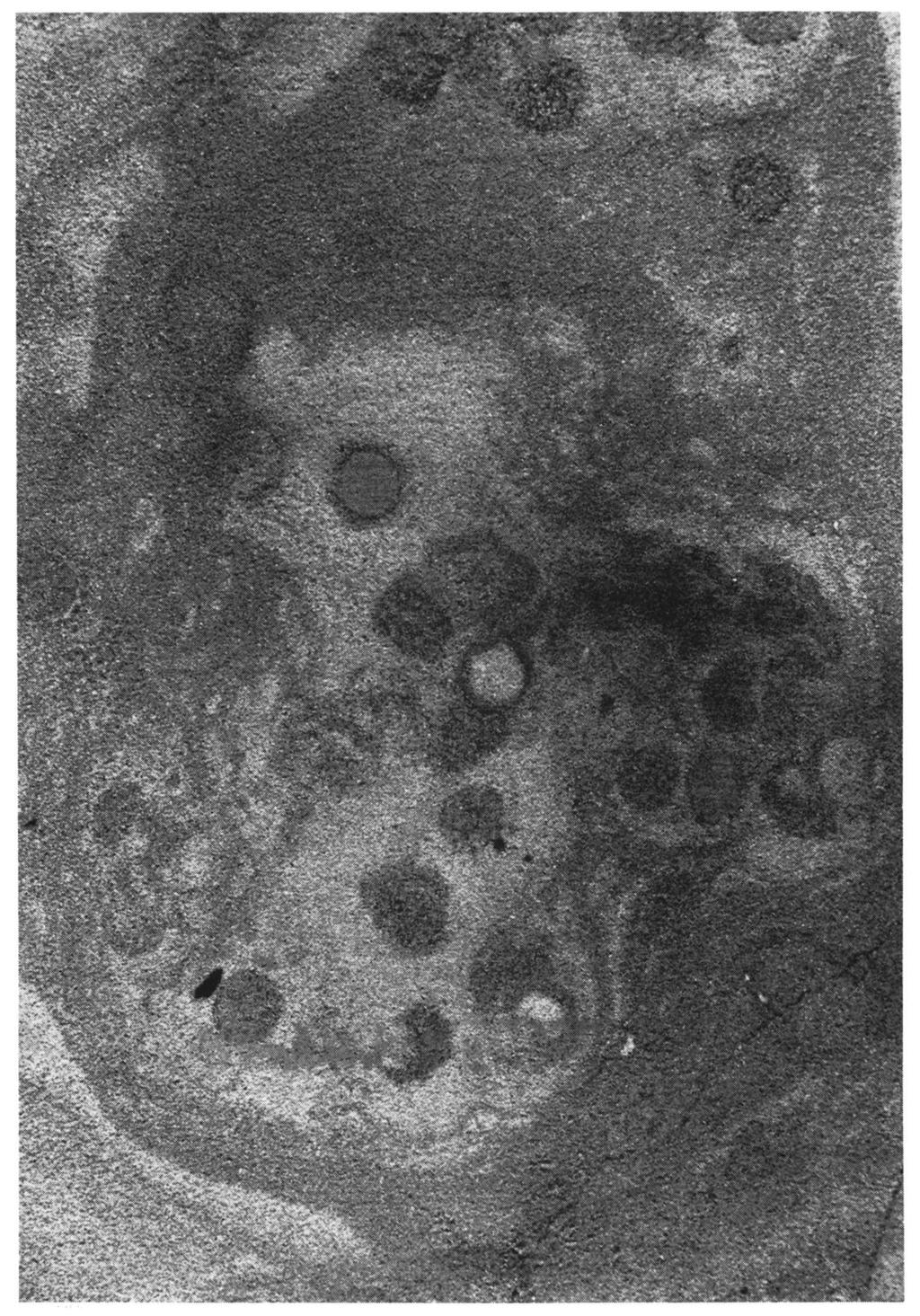 Fig. 9. Dwarsdoorsnede van een graafgangbundel van Bathichnus multiturbatae nov. spec. Holotype No VG-2252, coll. W.M.