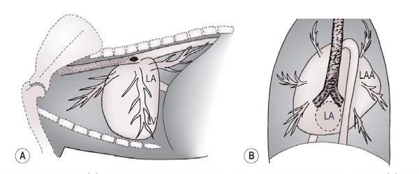 Hoe weet je of een dier in linker congestief hartfalen is? Tekenen op RX thorax 1. Cardiomegalie linker hart: Vergroting van het linker ventrikel Vergroting van het linker atrium 2.