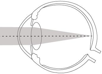 De oog-lens buigt het licht, zodat het licht op het net-vlies valt. De ooglens beschermt het oog. Wanneer heb je een bril nodig?