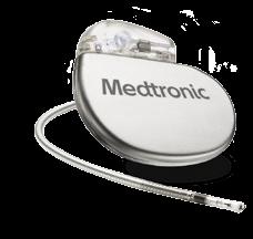 EEN MICRA GEÏMPLANTEERD KRIJGEN MICRA-PACEMAKER IN HET HART De Micra is 93% kleiner dan een traditionele pacemaker en heeft een batterij die net zo lang meegaat als die in traditionele