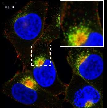 Praktijkvoorbeeld: MS risicogen CLEC16A linkt aan T-cel activering