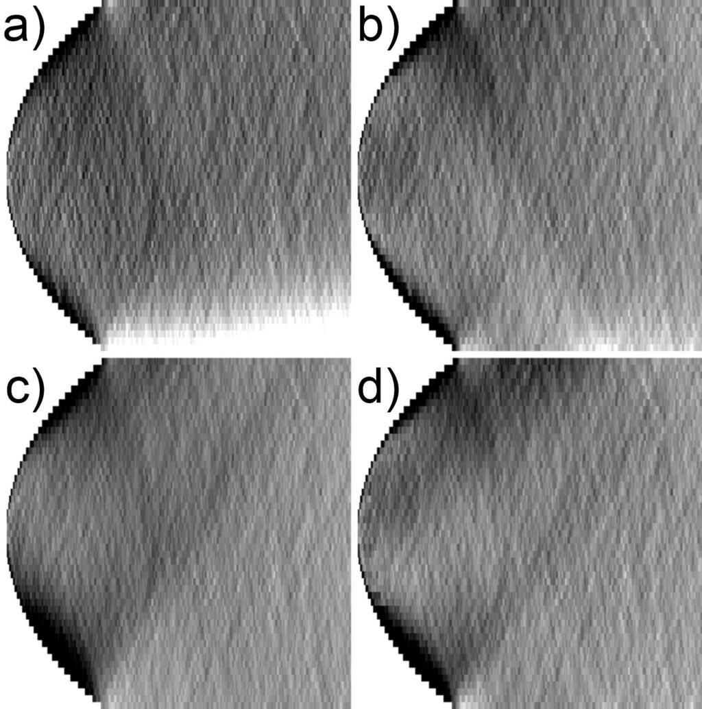 CHAPTER 5. MULTIGRID RECONSTRUCTION 124 Figure 5.8: Artifacts in the coronal plane (the XZ plane in figure 5.1) for one noise realization of the phantom reconstructions.