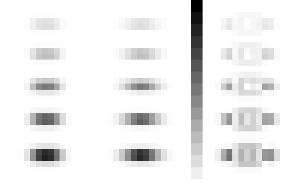 CHAPTER 4. PATCHWORK RECONSTRUCTION 90 Figure 4.3: Projection of five calcifications (diameters: 100, 125, 150, 175, and 200 µm) located at 60 mm above the detector.