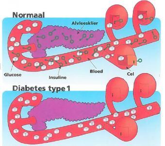 2.Wat is diabetes?