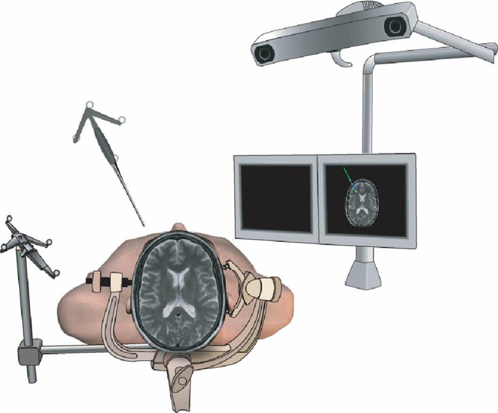 Stereotactische Navigatie R1