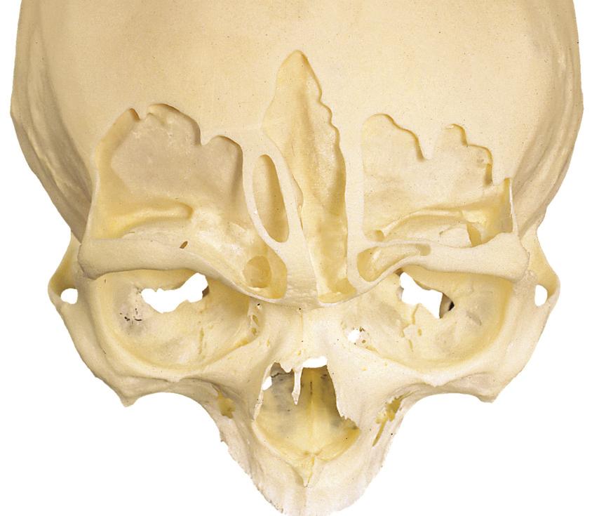 Neusbijholten 2.9 Gezichtsschedel met geopende voorhoofdsholten, vooraanzicht.