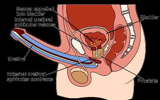 Ejaculatiestoornissen Retrograde ejaculatie 15 % diabetici T.g.v.