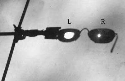 Opgave 4 Bril Ineke zet een statief waarin een bril is geklemd, buiten in de zon. Het zonlicht valt op de brillenglazen en wordt afgebeeld op een wit scherm. Zie figuur 1.