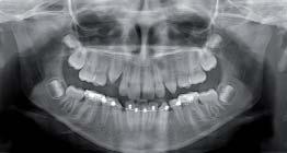 Dit is het mooie van 3D-technologie: het systeem geeft anatomisch correcte beelden op het scherm weer.