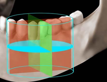 Nauwkeurig, veilig en eenvoudig Gelokaliseerde weergave Het Kodak 9000 3D-systeem beschikt over een functie voor gelokaliseerde weergave van hoge resolutiebeelden en voxelomvang.