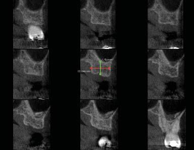 Een orthogonaal sjabloon voor doorsnede (b) kan automatisch worden gegenereerd