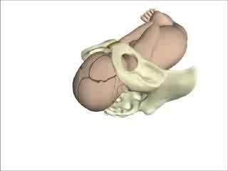 Noodsituaties in de verloskunde Uitgezakte navelstreng Schouderdystocie Niet nakomend hoofd bij stuitbevalling