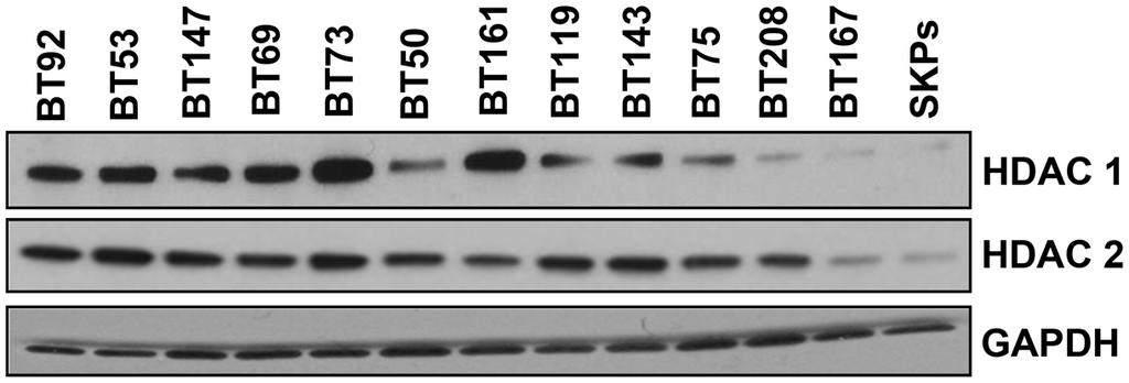 Supplementary Figure 5: HDAC1 and HDAC2 protein