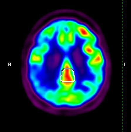 cingulate