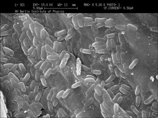 Fosfaat mineraliserende bacteriën Positieve resultaten met Bacillus subtilis Bodembacteriën, zwemmen naar wortels en leven in symbiose met de plant Organisch materiaal rond de wortels wordt versneld