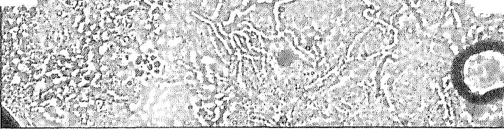 zal verhogen. Een voordeel van de orale be- ZSEKTEGESGH1EDEN1SSEN naire, erythemateuze afwijkingen gezien met een colleretteschilfe- Aan de hand van enkele casus ring (fig. 1).