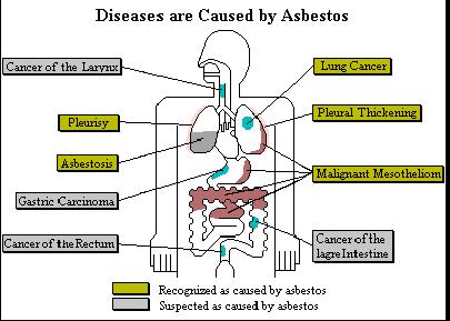 Risicofactoren asbest Vezelstructuur Fijne vezels, blijven splitsen Blijven hangen in de longblaasjes Biopersistentie Asbest is onverwoestbaar Kan niet worden afgebroken door ons afweersysteem
