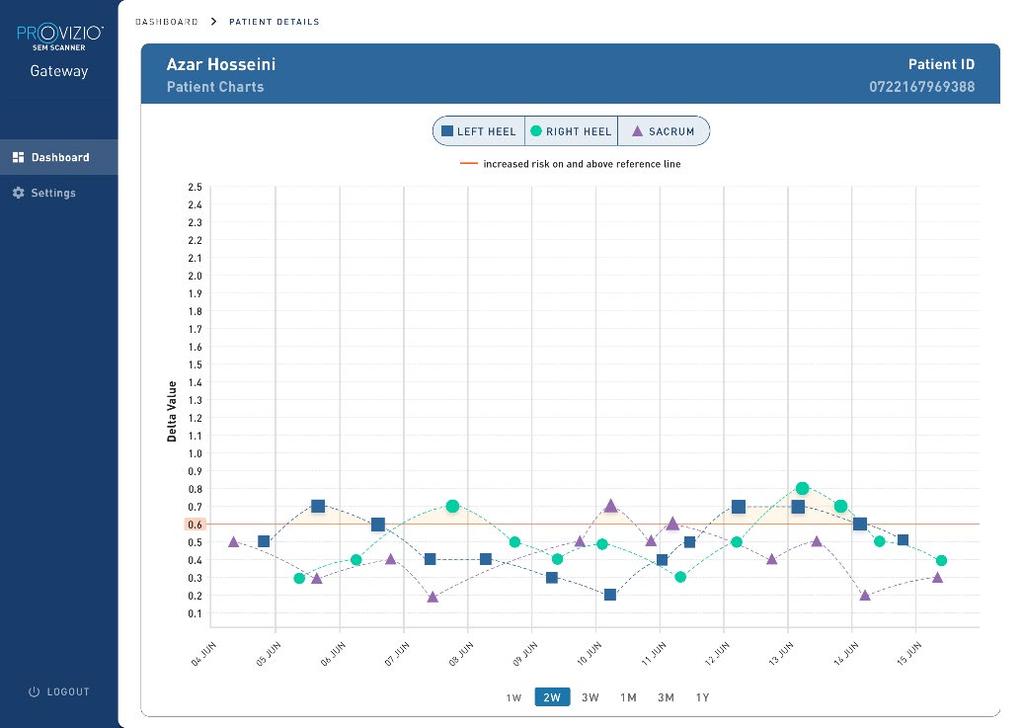 4.2. Patient Chart (Patiëntengrafiek) De Patient Chart (Patiëntengrafiek) pagina toont een plot van de deltawaarden over een tijdsperiode die kan worden