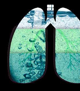 REPORTAGE Eerste resultaten bij kanker veelbelovend Toen onderzoekers alle literatuur over waterstof-therapie bij kankerpatiënten analyseerden, ontdekten ze dat de lichamelijke toestand van maar