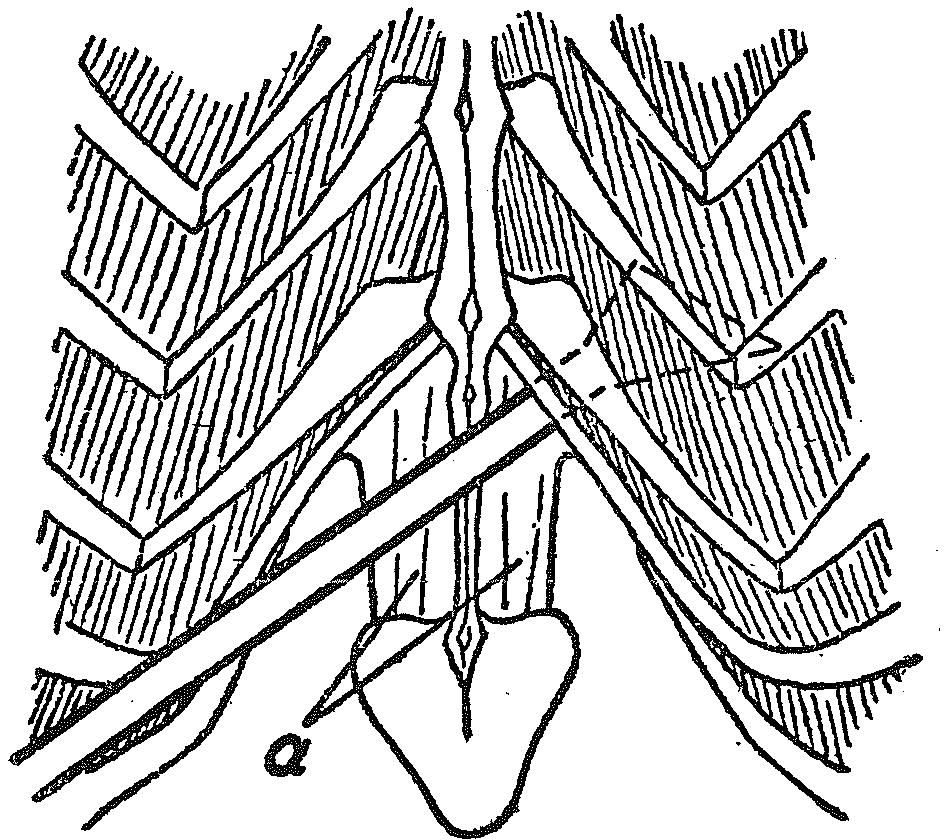 36 door een laag buikspieren ( m. rectus abd. en m. obliquus major) en eenig bindweefsel, hierdoor kan de canule worden ingebracht tusschen diaphragma en thoraxwand.