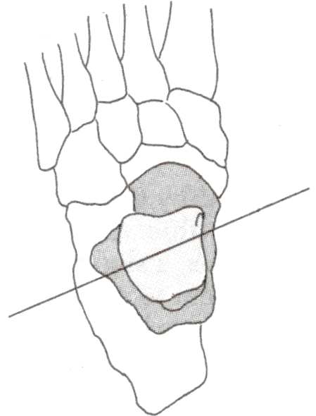 Dr d vl ligamntn di rnd d nkl aanwzig zijn is d bwging quasi uniaxiaal rnd n schuinliggnd as. Mn nmt algmn aan dat d as in ht frntaal vlak ngvr 10 naar bndn hlt aan d buitnzijd van d vt (zi figuur 1.