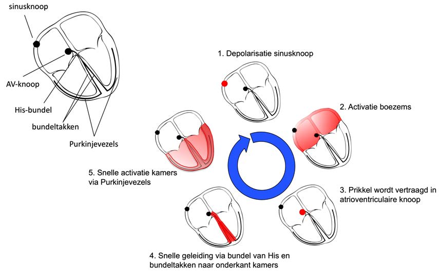 4.4. Elektrische activatievolgorde van het hart Bij een normale hartslag ontstaat de eerste actiepotentiaal in een cel van de sinusknoop.