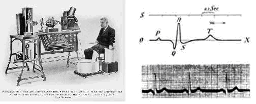Echter, de oorspronkelijke registraties van Einthoven blinken uit door hun overduidelijke en ruisvrije signalen. In hoofdstuk 1.3 is de pompcyclus van het hart beschreven en in hoofdstuk 4.