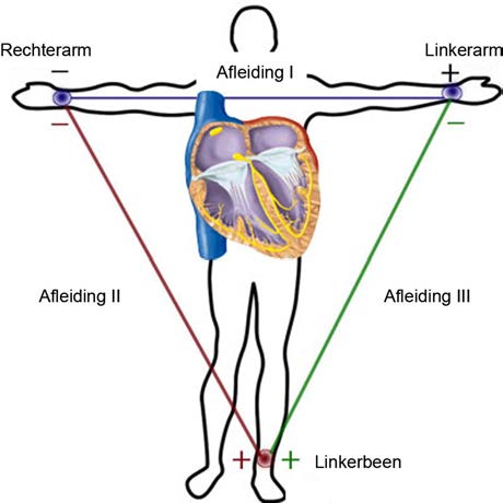 Kort samengevat (figuur 39) komt het op het volgende neer: Figuur 39: Depolarisatierichting versus uitslag op het ECG 4.7.