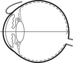 INFORMATIEBLAD HET OOG Dit is de dwarsdoorsnede van het oog. Het oog zit knap in elkaar.