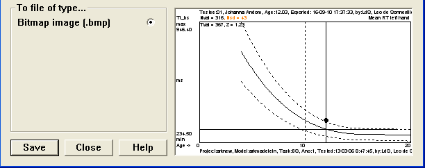 Afdrukken en exporteren van lijngrafieken (1) 1: Dubbelklik in het Saved scores scherm op de lijngrafiek die u wilt afdrukken 1 a : Pas eventueel de schaling aan (2) 1 b :