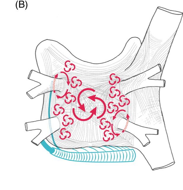 Boezemfibrilleren A conceptual model of atrial fibrillation.