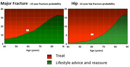 mogelijke tool hiervoor is FRAX: Fracture Risk Assessment Tool o parameters leeftijd geslacht gewicht en lengte (want dunne dametjes krijgen breuken) voorgaande fractuur heupfractuur bij ouders