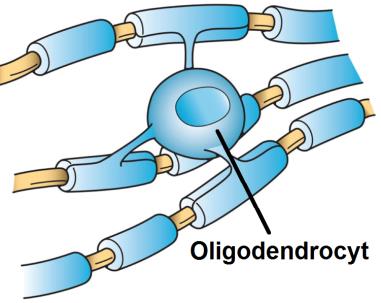 ontstaat is vooralsnog onduidelijk. Mogelijk spelen genetische factoren, in combinatie met omgevingsfactoren, een rol. Symptomen? Door ALS worden de bewegingscellen aangetast.