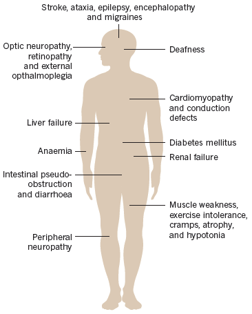 mitochondriale aandoeningen zeer heterogene groep aandoeningen multi-systeem ziekte waarbij vele weefsels en organen betrokken (kunnen) zijn incidentie 1/5000 geen