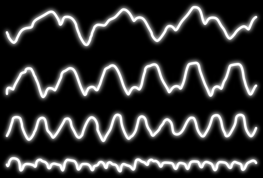 DE VIER HOEKSTENEN VAN AVE EEG-REGISTRATIE VAN WIJZIGINGEN IN DE HERSENACTIVITEIT Het uitgangspunt van entrainment heeft betrekking op het veranderen (aanpassen) van de hersengolfactiviteit.