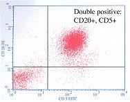 CLL :